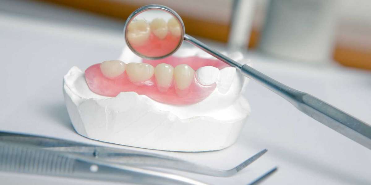 Unlocking Grins: Exploring the Services of Dentures Clinics