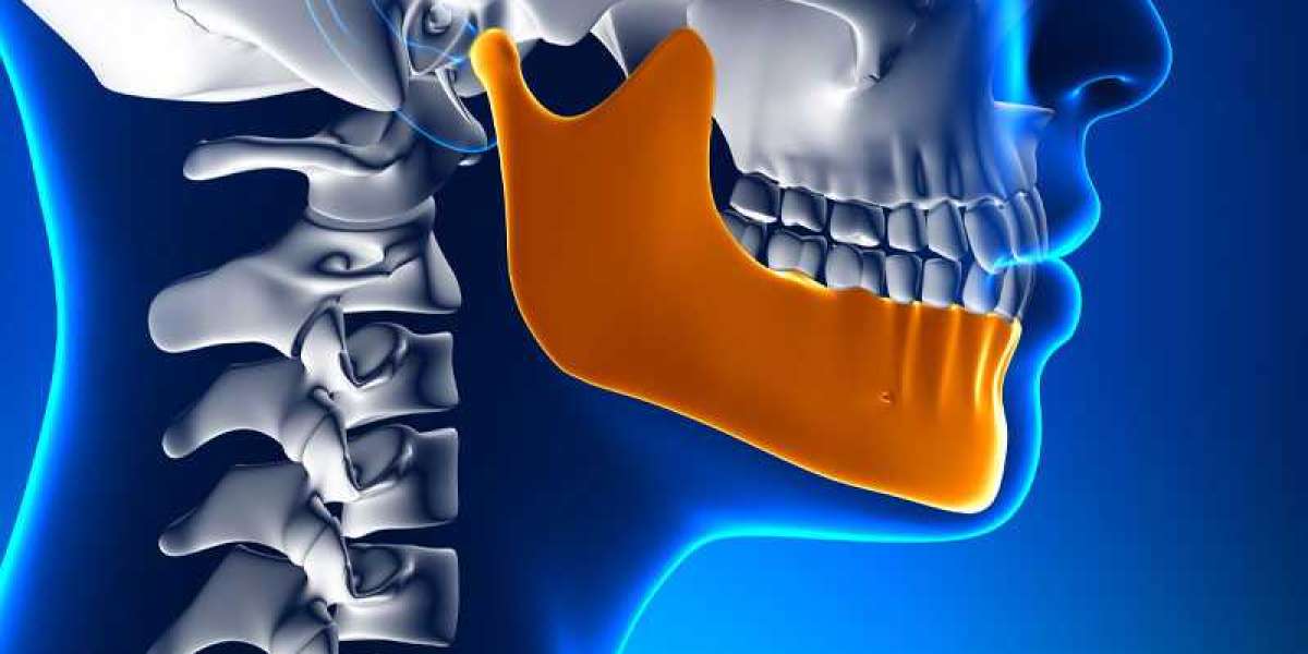 Engineered for Mobility: TMJ Implants Market Poised to Revolutionize Jaw Function