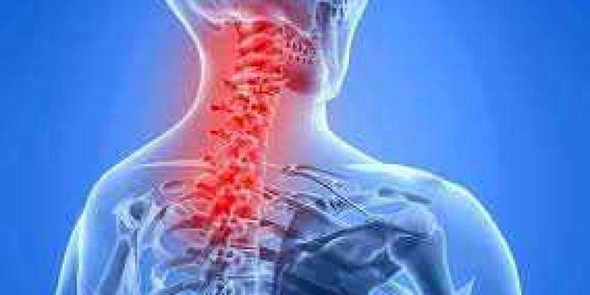 Neck Pain: What Is, Causes, Symptoms & Best Treatment