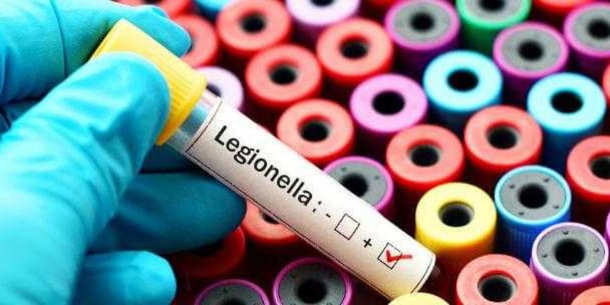 Global Legionella Testing Market Size & Share Analysis 2031