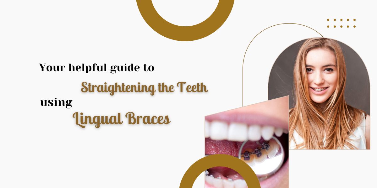helpful guide to straightening teeth using lingual braces