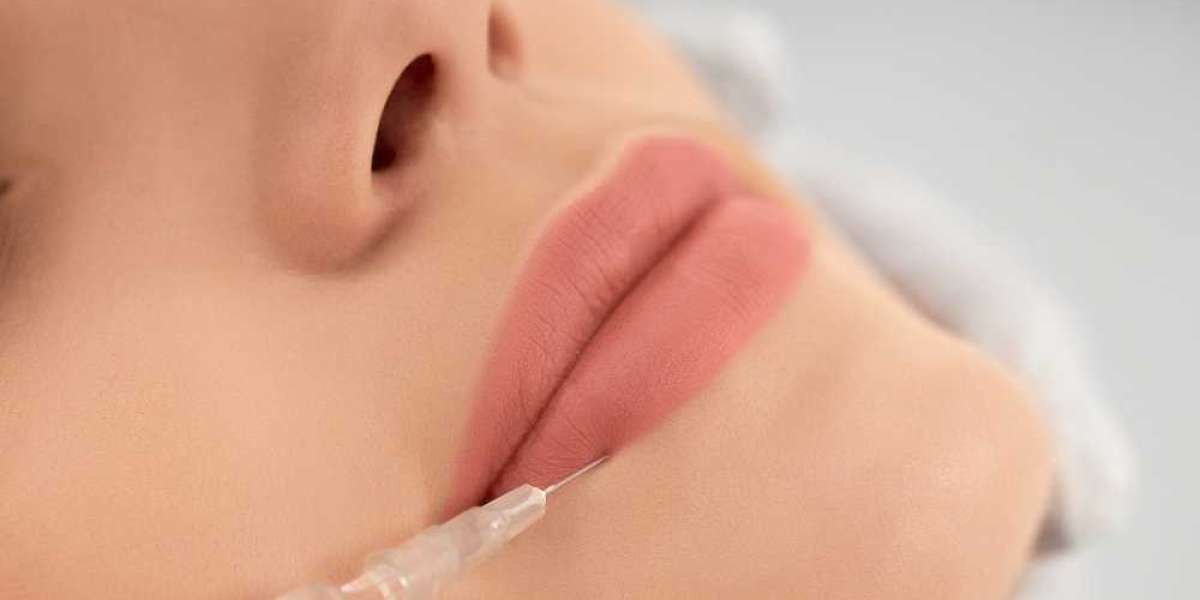 Expert Lip Injections at Premier Botox Clinic