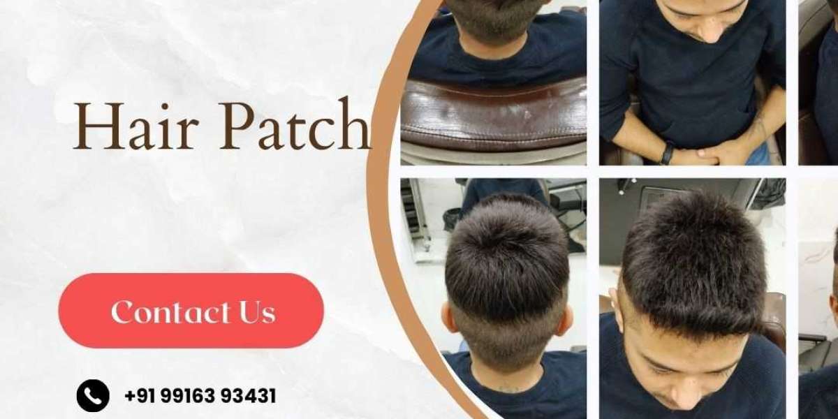 How much does hair patch cost in Bangalore?