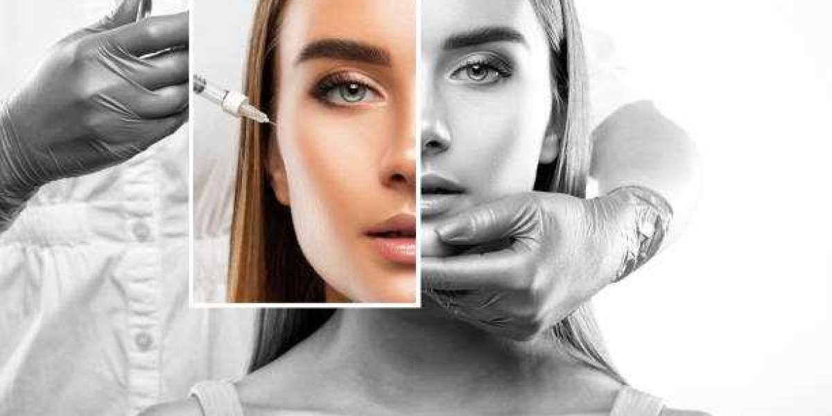 The Ultimate Beauty Boost: Cheek Filler Injections in Riyadh