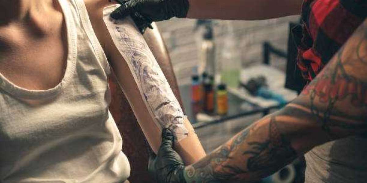 Papering Past: Tattoo Removal in Riyadh Unveiled