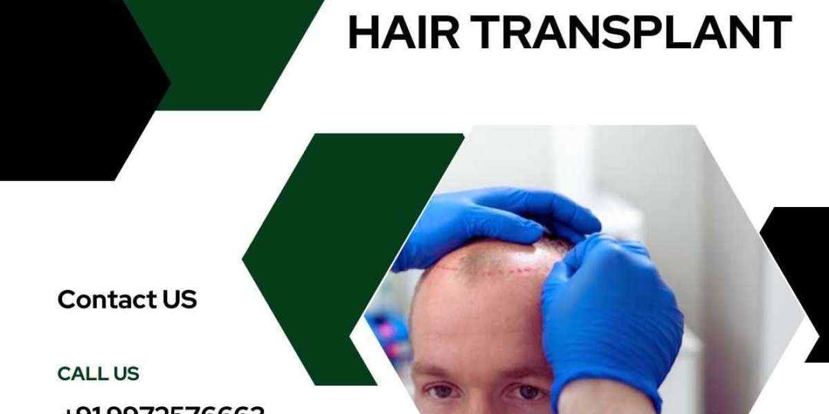 How Much I Can Expect to Pay for a Hair Transplant?