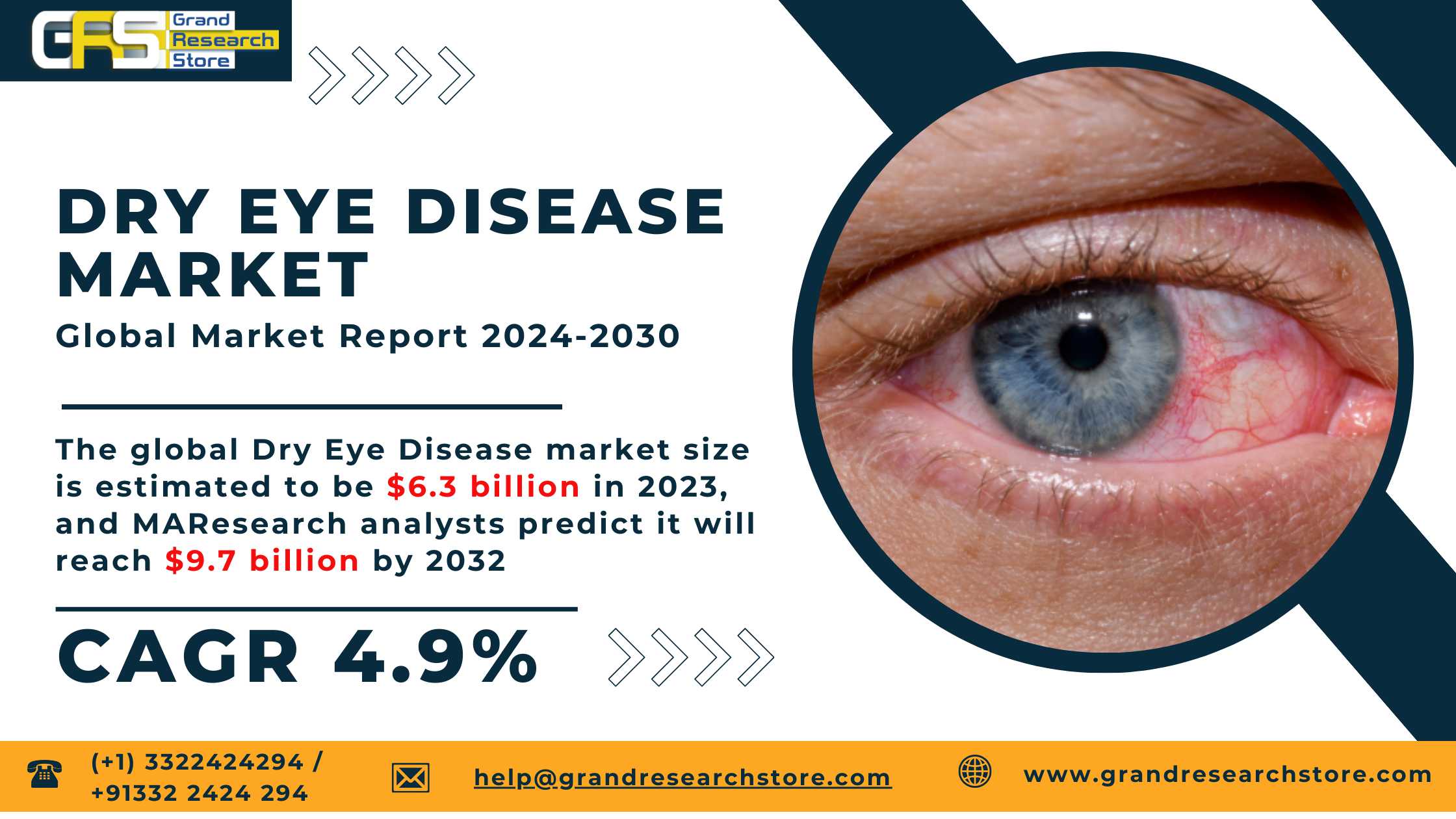 Dry Eye Disease Market 2024-2030 Global by Player,..